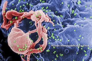 HIV virus